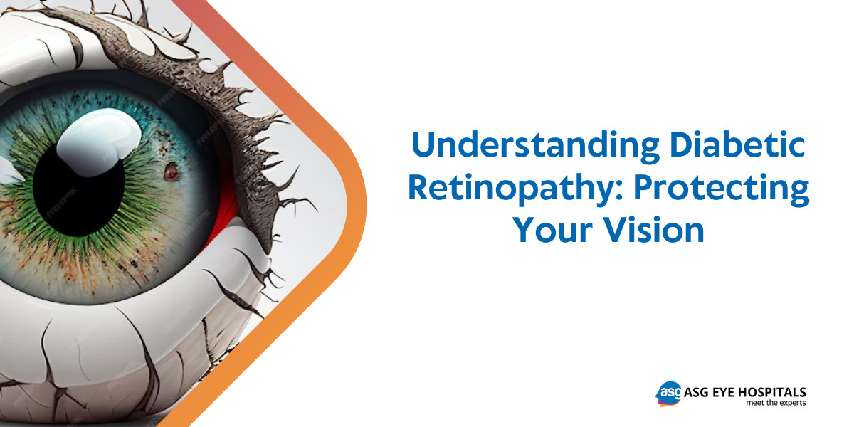 Understanding Diabetic Retinopathy: Protecting Your Vision